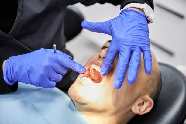 Best Emergency Gum Treatment in Patrick Af, FL